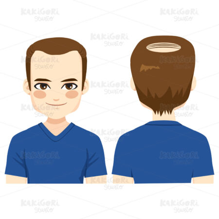 Bald Man Problem Clipart Vector Illustration 03376