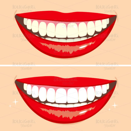 Before and After Smile Clipart Vector Illustration 01457