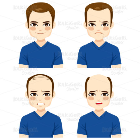 Male Hair Loss Stages Clipart Vector Illustration 02752